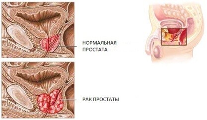 Інформація про захворювання